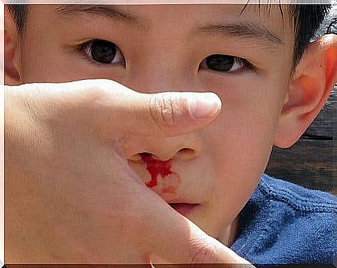 Blood flowing from the boy's nose