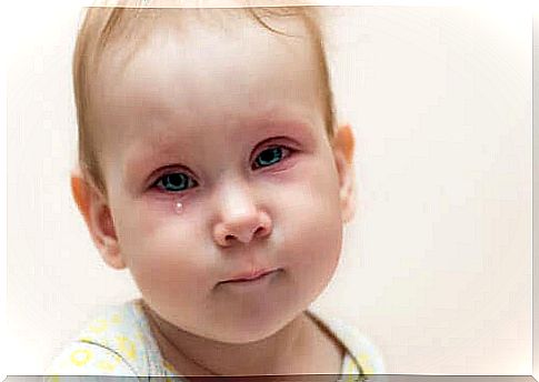 Conjunctivitis in children - how to proceed?