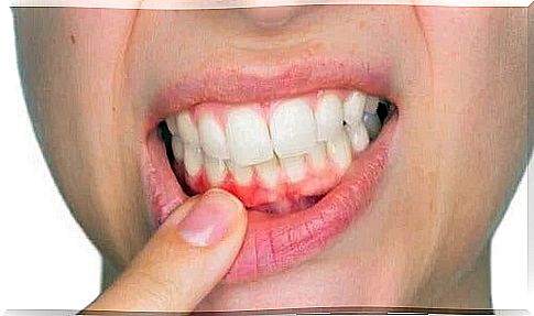 Dental abscess - what is it and how should it be treated?