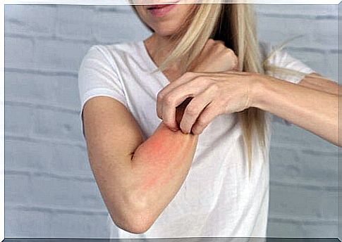 The photoallergic reaction has to do with the immune system.  The symptoms are similar to eczema.