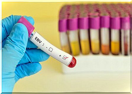 A significant symptom caused by mononucleosis is the presence of heterophile antibodies