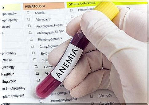 Anemia blood test 