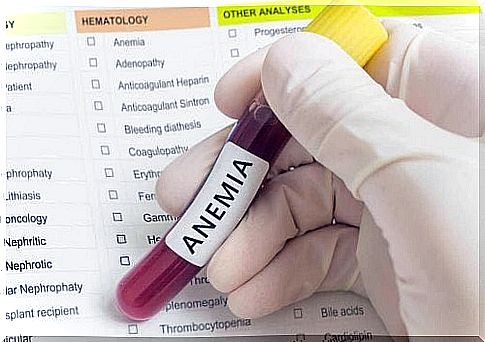 iron deficiency anemia