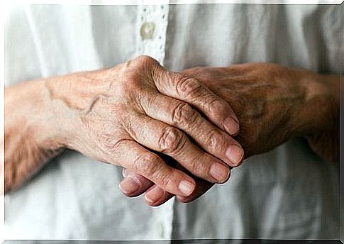 Arthritis-affected hands