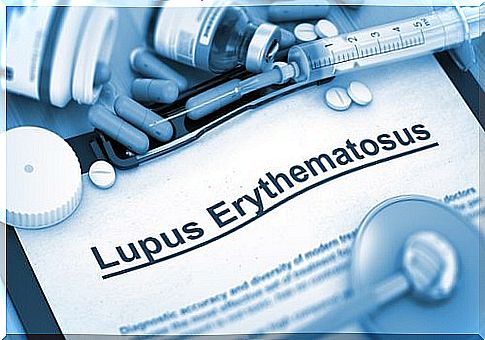 Lupus