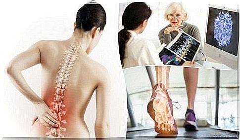 osteoporosis and its causes