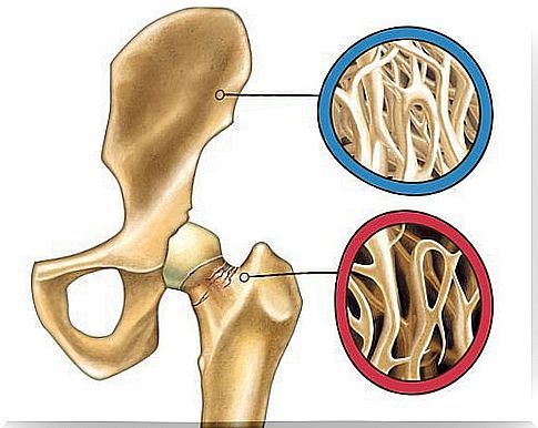 parsley strengthens bones