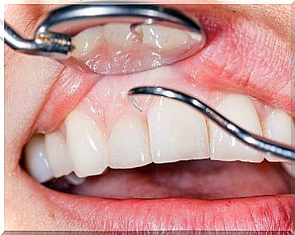 Examination of teeth and gums