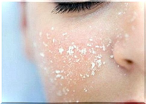 Salt flakes on the skin of the face